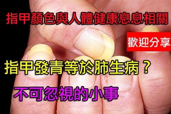 從指甲看健康：發青或有肺病指甲有異常需就醫...