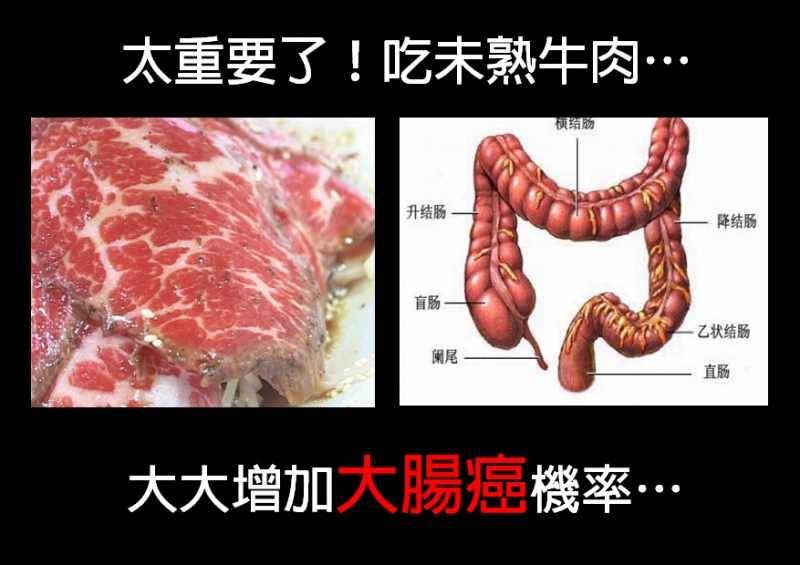 吃沒熟牛肉引發大腸癌，你還敢吃嗎？...