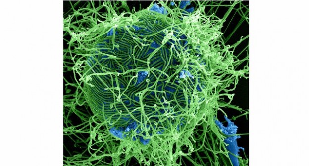伊波拉病毒會不會空氣傳染？|健康達人網...