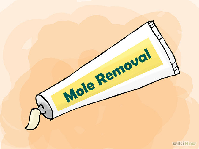 Remove Moles Quickly Step 01.jpg