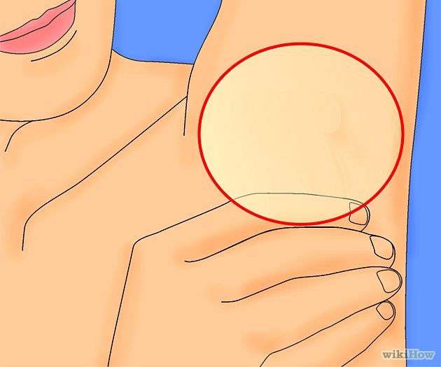 Heal Armpit Rash Step 5.jpg