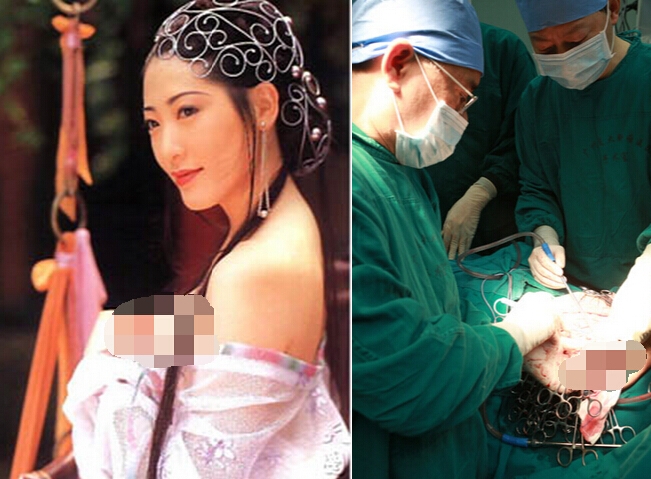 曾被譽為亞洲最美乳房的艷星楊思敏，當年竟因這個原因切除胸部．...