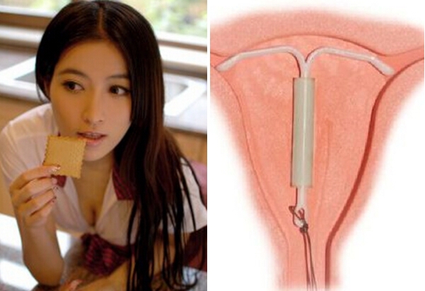 實拍美女害羞戴上避孕環手術過程．．想節育的女生一定要看看！...
