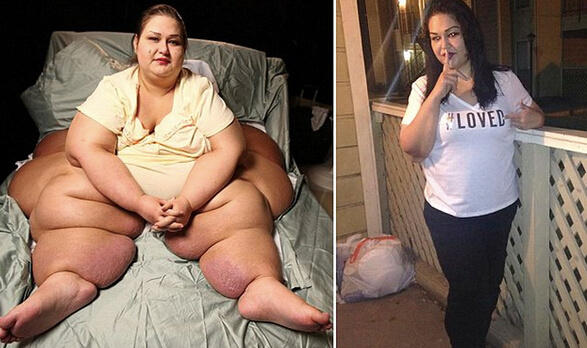 美國34歲900斤女子成功減掉700斤後甩掉老公...