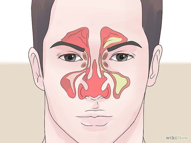Заложенность носа насморка причины и лечение. Строение носа при насморке. Заложенность носа без насморка.