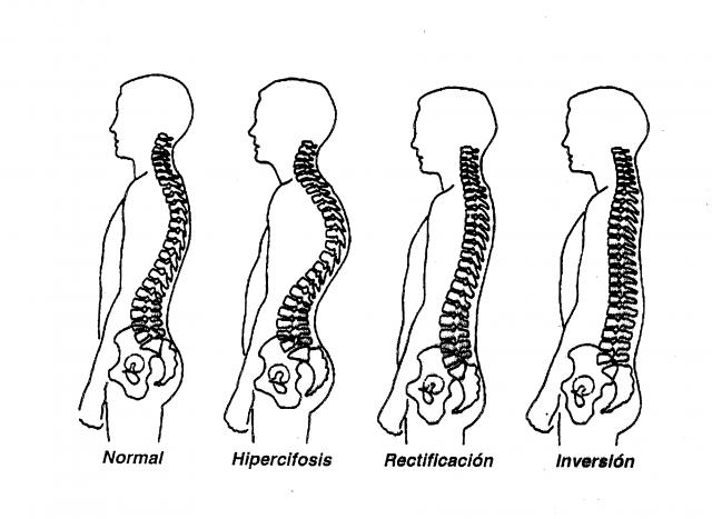 「脊椎」人一生的命根，若是歪了就不健康！這些方法我試了一週脊...
