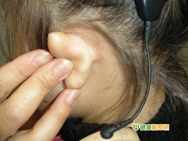 人工耳蝸讓聽障寶也可正常「聽說」...