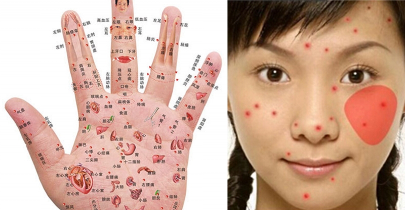 《幾乎失傳的手診》教你怎麼從手看健康；哪種痘痘暗示身體出毛病...