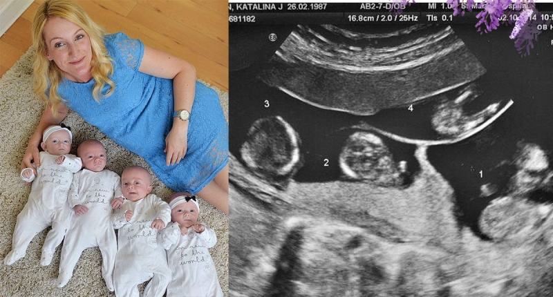 原本被宣告不孕的她，最後竟懷上「異卵」4胞胎！機率是70萬分...