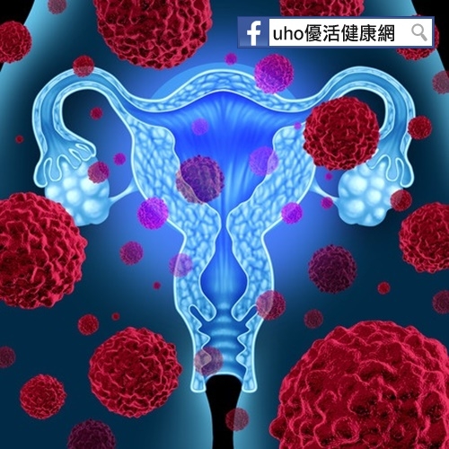 卵巢癌年輕化，_______是主因！...