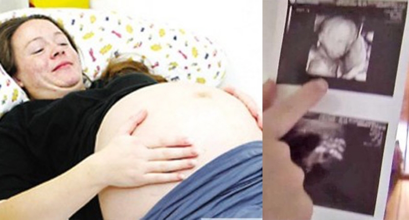 這對夫妻經歷數次流產，終於開心生了三胞胎，但當媽媽再度懷孕後...