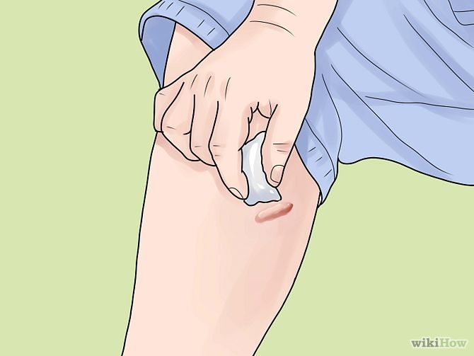 Remove Scars on Legs Step 1