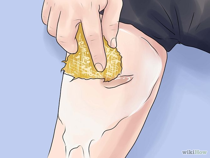 Remove Scars on Legs Step 17