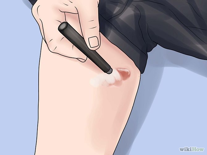 Remove Scars on Legs Step 20