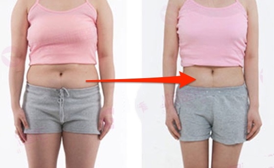 「月經」才是女人減肥真正的減肥期？超神月經瘦身法，做對效果翻...