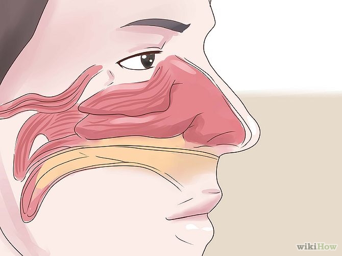 Get Rid of a Stuffy Nose Quickly Step 18
