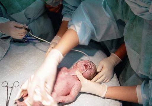 孕婦產房分娩就在嬰兒快出來時護士看見嬰兒的頭部徹底的傻眼了