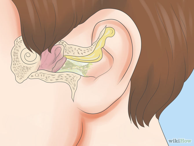 Get Rid of Ear Wax Step 1