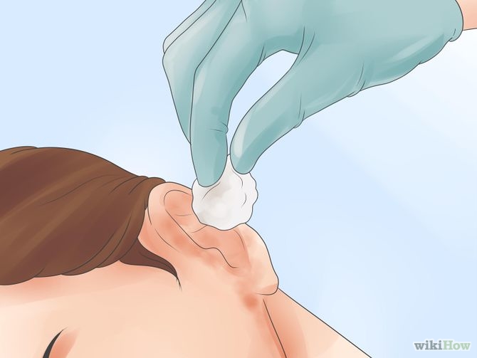 Get Rid of Ear Wax Step 11