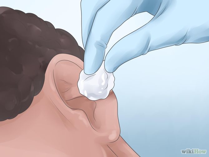 Get Rid of Ear Wax Step 16