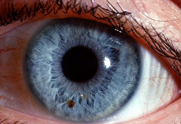 糖尿病病患要定期檢查眼睛，血糖過高可能會眼盲...