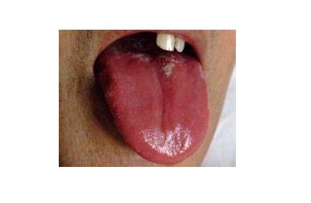 科學家標明，原來看一個人的腎好不好，看舌頭就知道！