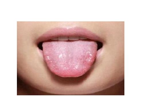 科學家標明，原來看一個人的腎好不好，看舌頭就知道！