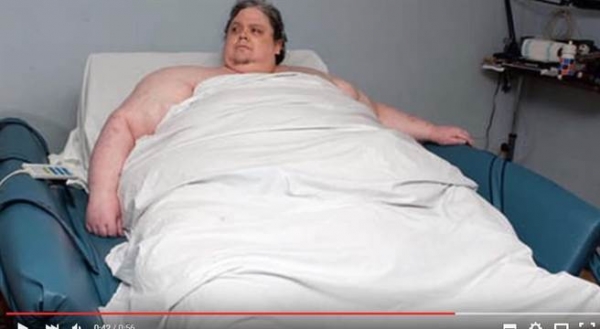 445公斤肥胖男子，被醫生警告再不減肥性命不保，沒想到醫生幫...