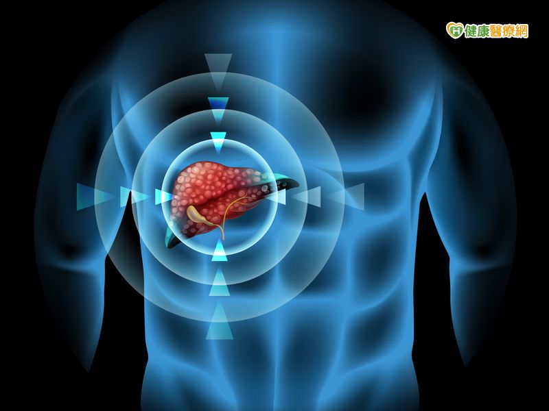 立體定位消融放射治療擺脫肝癌重獲新生...