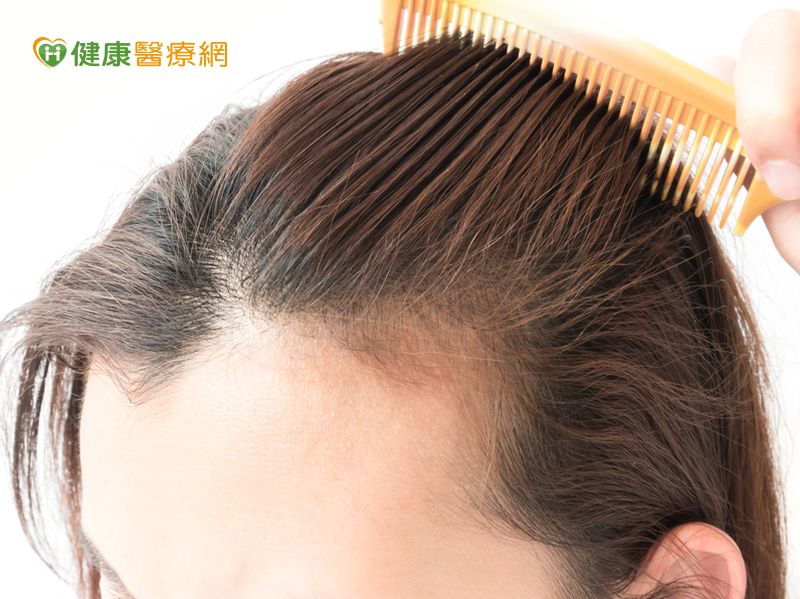 化療後頭髮會長回來稀疏髮量有方法可改善...