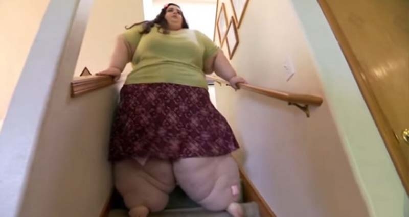 這個290公斤的女胖子瘦下來後，不但顏值回升還意外「撞臉赫本...