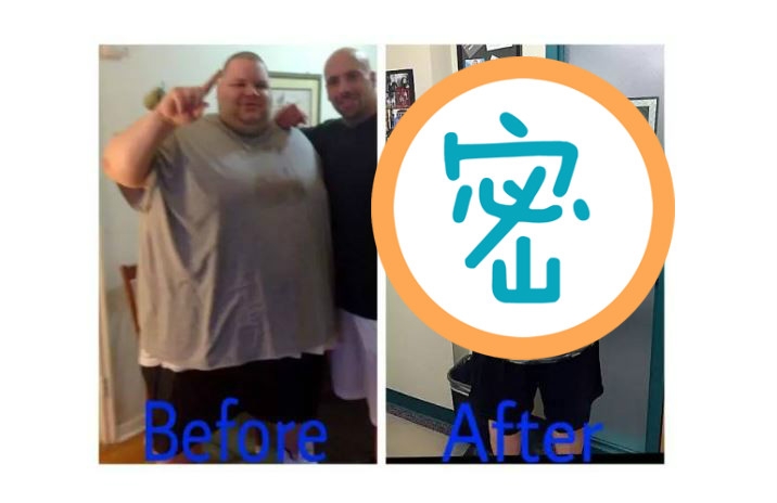 這名男子胖到3百多公斤，醫生警告他如果再不減肥可能會死亡，最...